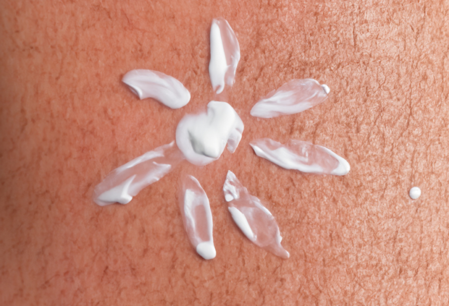 Sonnenschutz ist eine wichtige Präventionsmaßnahme bei Vorstufen von weißem Hautkrebs