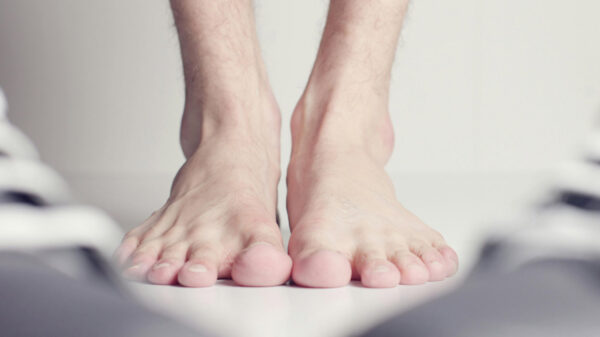 Nagelpilz behandeln: Vorbeugung ist das A und O.